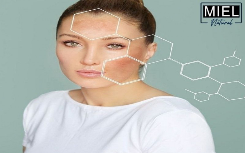 Miel Natural |  What Are Free Radicals & How Do They Affect My Skin?
