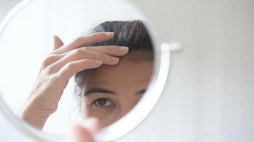 Hair Transplant Surgery: Does it Work for Women?