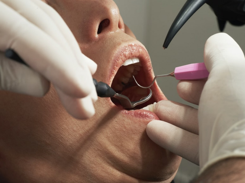 Hire Orthodontists and Align Your Teeth and Jaws Properly