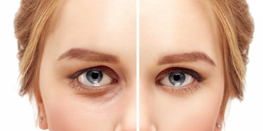 Why and When Our Wrinkles Come?