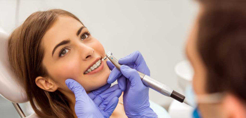 Everything You Need to Know About Professional Teeth Whitening And its Benefits: