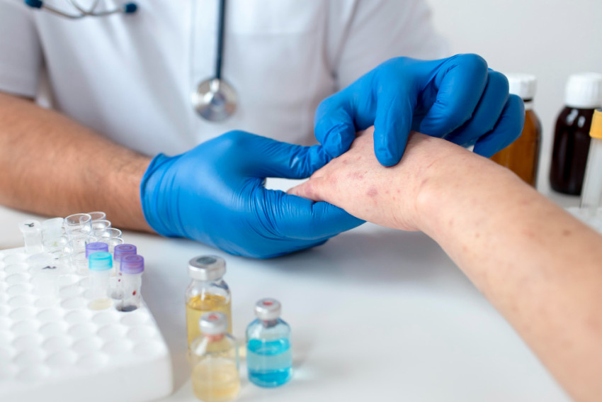 What are the Benefits of Allergy Testing