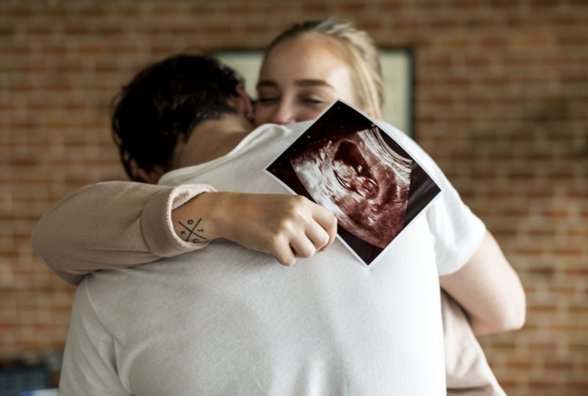 Beyond The Basics: Understanding Gender Scans In Perth