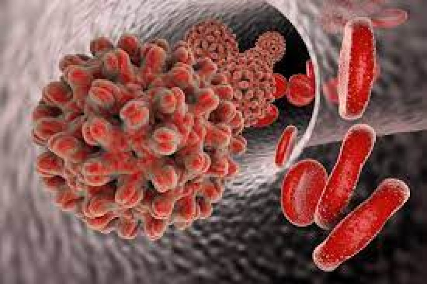 Hepatitis B Market: Epidemiology, Trends, Demand, Share, Size (2023-2033)