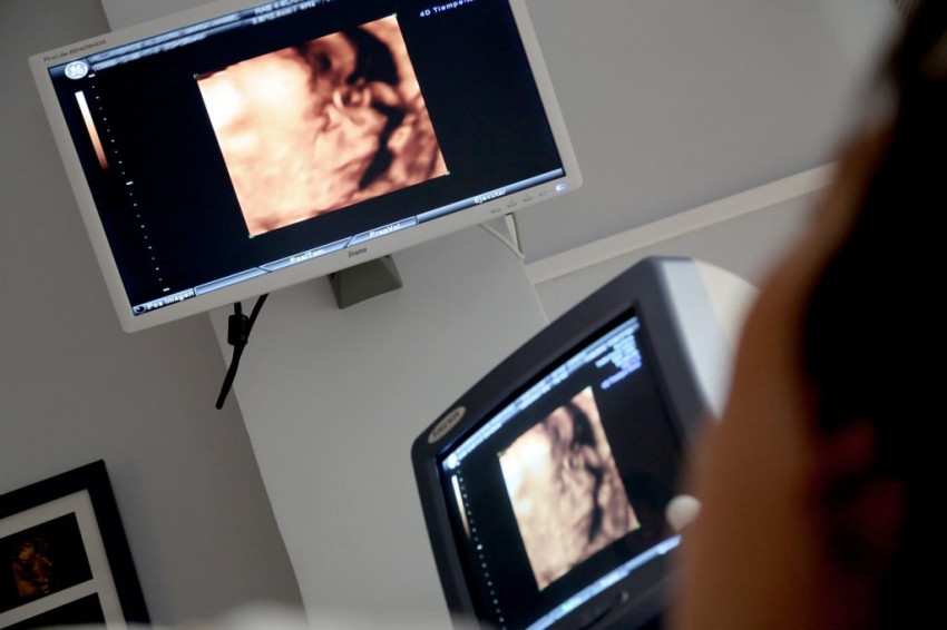 The Advancements In Ultrascan Radiology: A Game-Changer In Medical Imaging