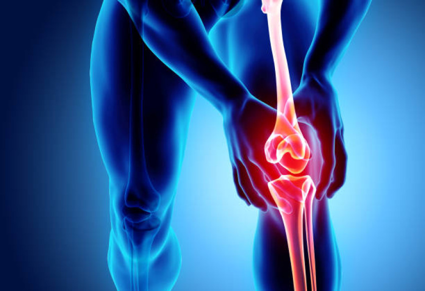 Maintaining Joint Support: 5 Actions You Can Take Today to Promote Healthy Joint Support