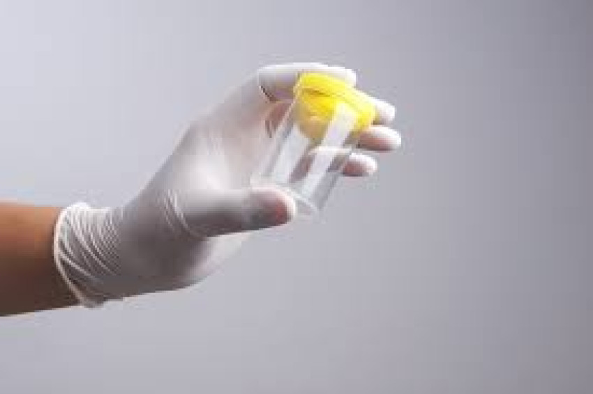 Comprehensive Guide to Lab Drug Testing Services: Everything You Need to Know!