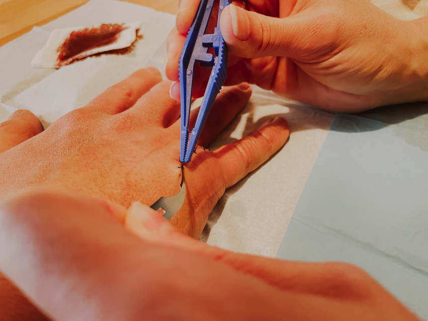 How Do I Find the Best Hand Surgeons in My Area?