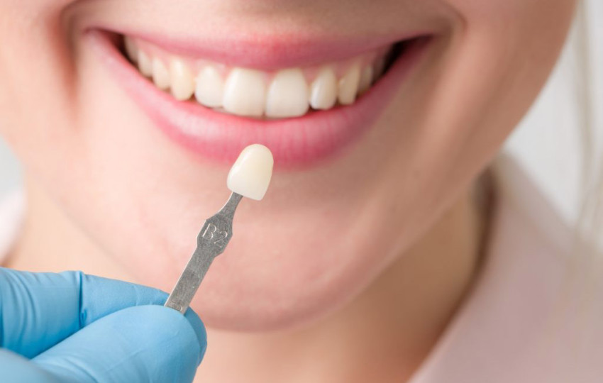 Tuxedo Dental: Your Path To A Stable, Beautiful Smile