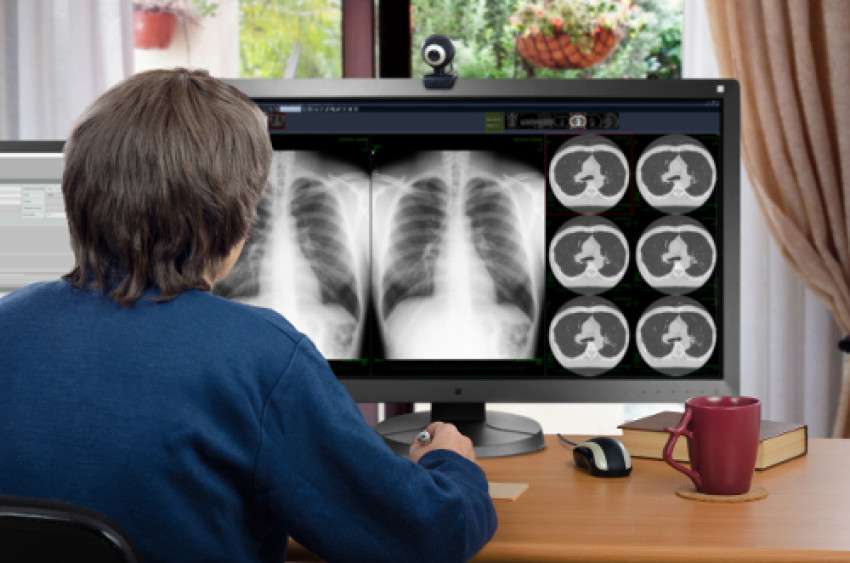 online CT scan reporting in telangana