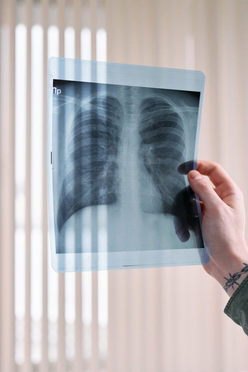 Pleural Effusion Treatment in Homeopathy