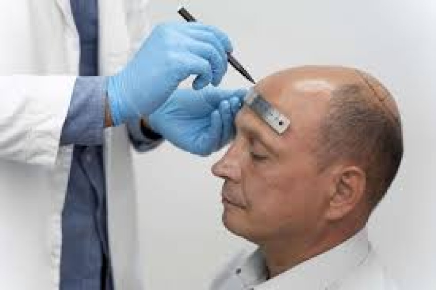 Hair Transplants in Dubai: Results You’ll Love