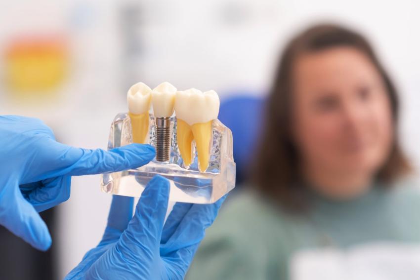 Dental Implants Norwich | In a Day | Pearl Dental Surgery