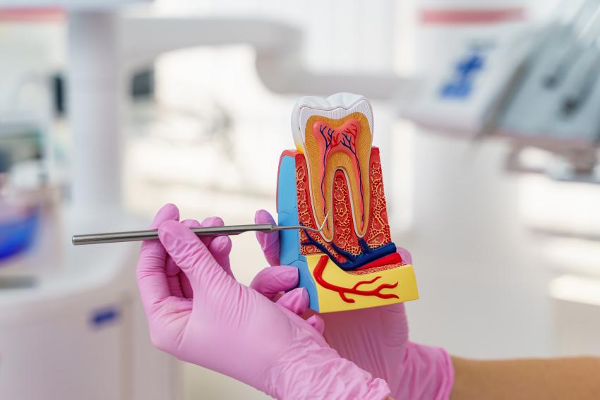 Signs you need a root canal: Don’t ignore these symptoms