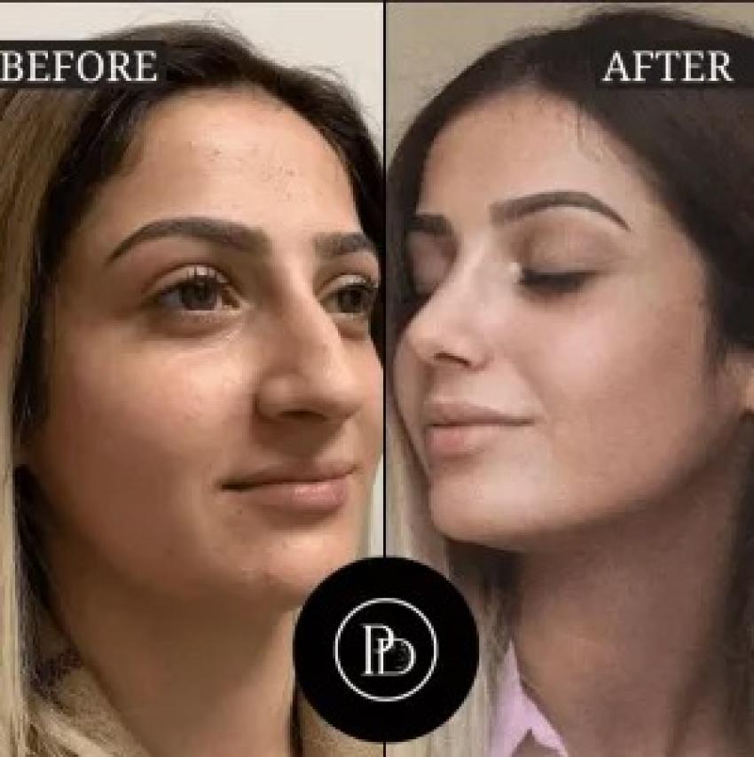 Why I Trust Only the Best Doctors in Dubai for My Skin & Wellness