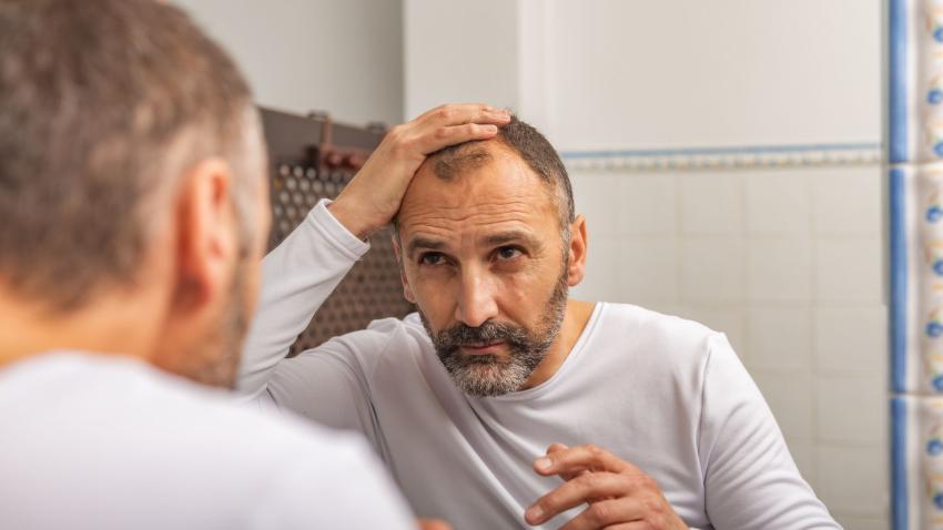 10 Natural Remedies to Stop Hair Fall
