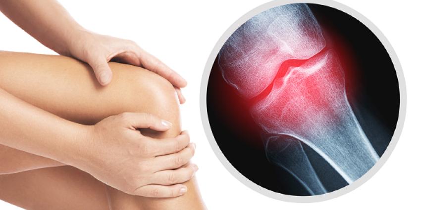 Joint Pain vs. Muscle Soreness: A Knowledge of Difference