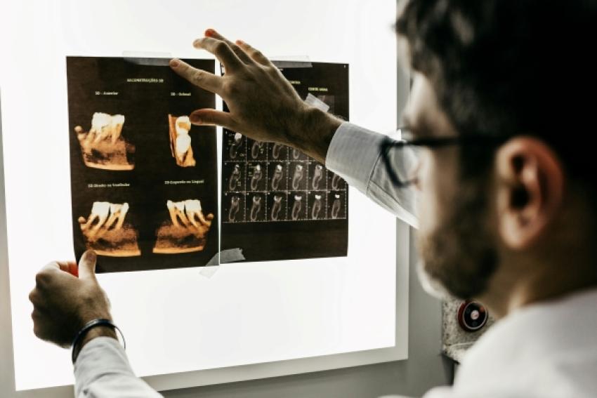The Professional Benefits of Investing in Implant Courses