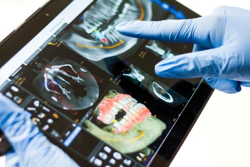 Why Dental Implant Training Is Important for Those Working as Dentists