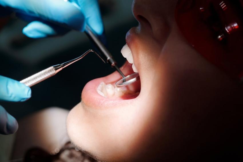 Dry Socket After Wisdom Tooth Removal: Early Signs, Pain Timeline and When to Call Us
