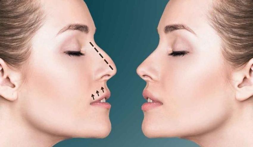 تجميل الأنف للرجال في دبي: معايير الرجولة والوسامة في الجراحة