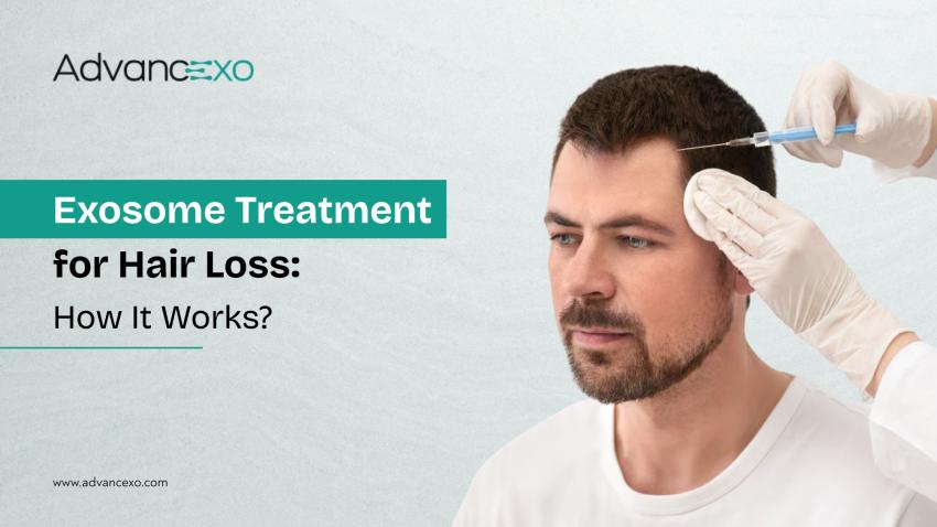 Exosome Treatment for Hair Loss: How It Works?