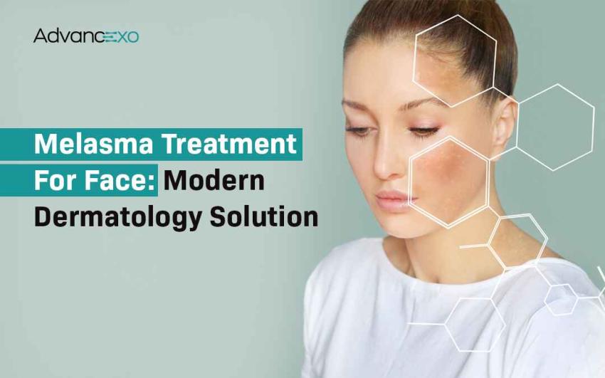 Melasma Treatment for Face: Modern Dermatology Solution