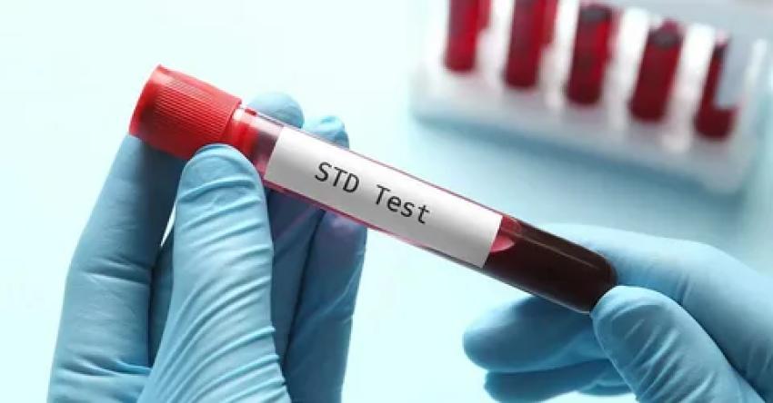 STD Test in Dubai: Advanced Lab Panels for Complete Peace