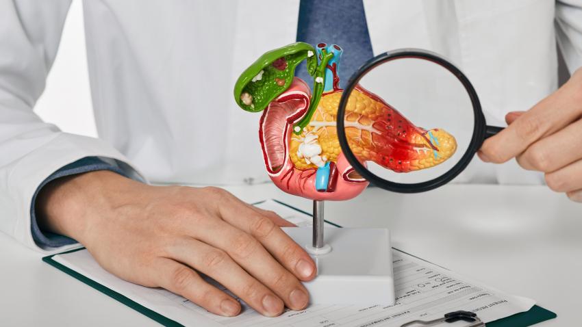 Complications of Untreated Pancreatic Stones