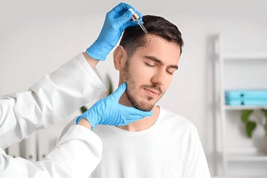Hair Transplant in Dubai: Achieve a Natural Hairline