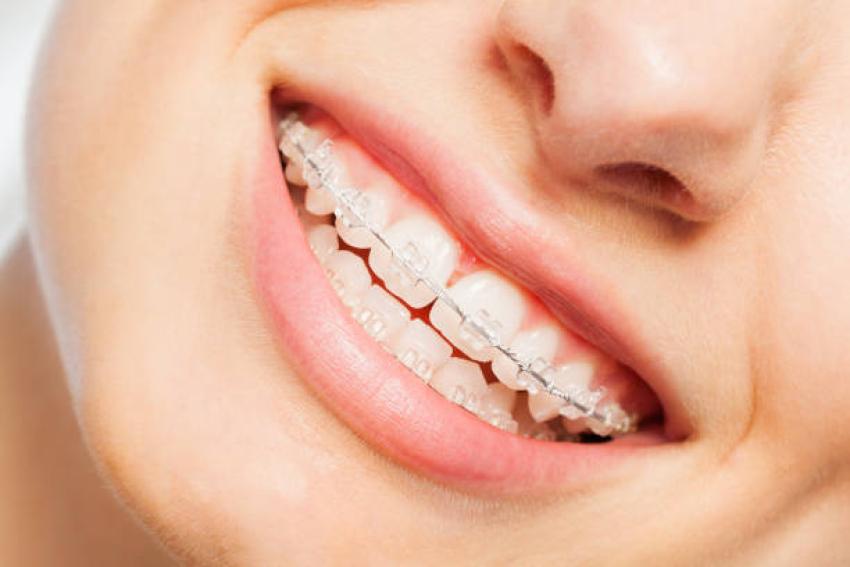 A Straighter Smile Starts with Confidence in Milwaukie