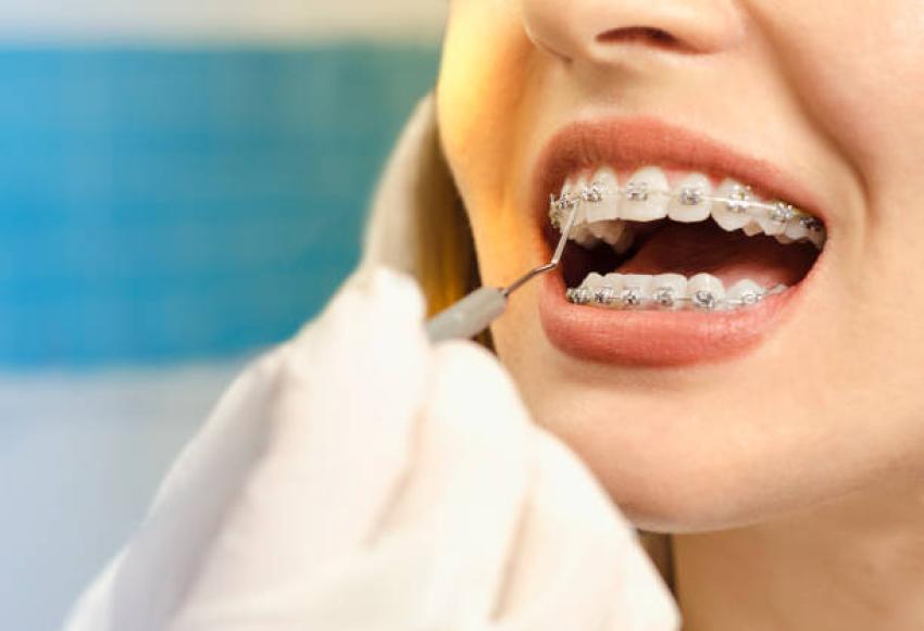 Creating a straighter smile through early orthodontic treatment