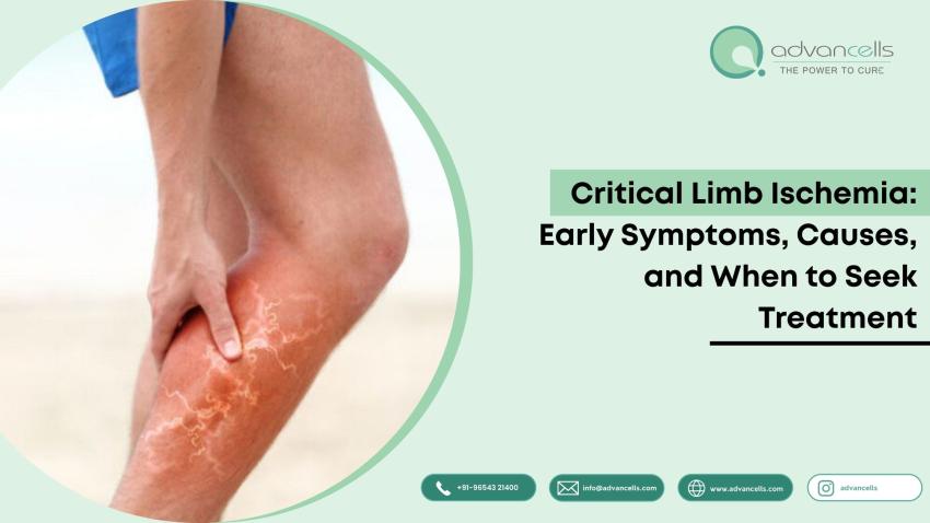Critical Limb Ischemia: Early Symptoms, Causes, and When to Seek Treatment