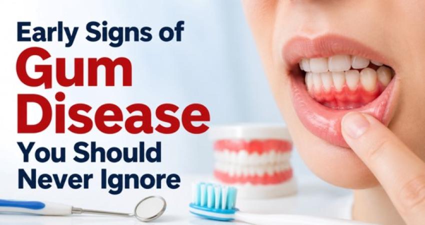 Early Signs of Gum Disease You Should Never Ignore