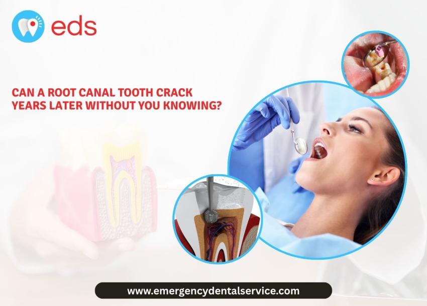 Can a Root Canal Tooth Crack Years Later Without You Knowing?