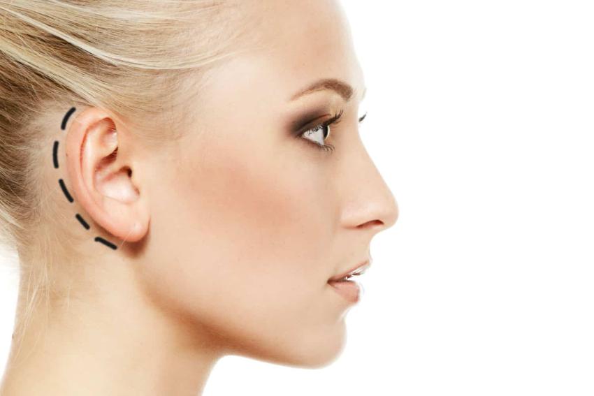 Best Age for Otoplasty in Islamabad: Children vs Adults