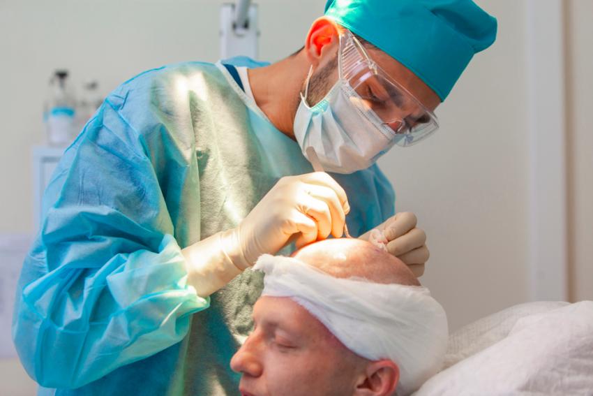 How Long Does Hair Transplant Take to Show Results?
