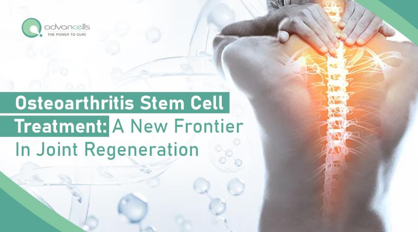 Osteoarthritis Stem Cell Treatment: A New Frontier in Joint Regeneration