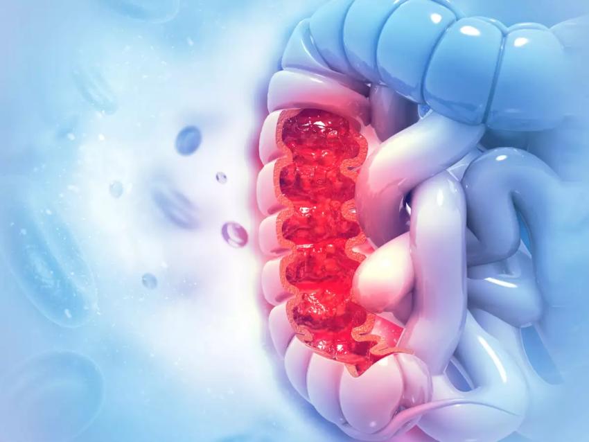 Colon Cancer Screening in Dubai: Key Tests and Benefits Guide