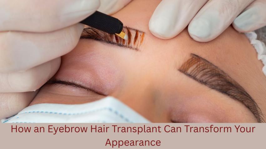 How an Eyebrow Hair Transplant Can Transform Your Appearance