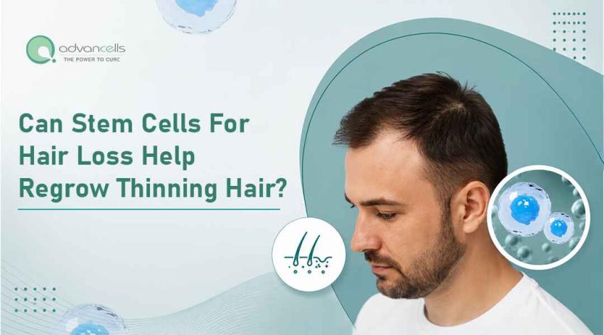 Can Stem Cell for Hair Loss Help Regrow Thinning Hair?