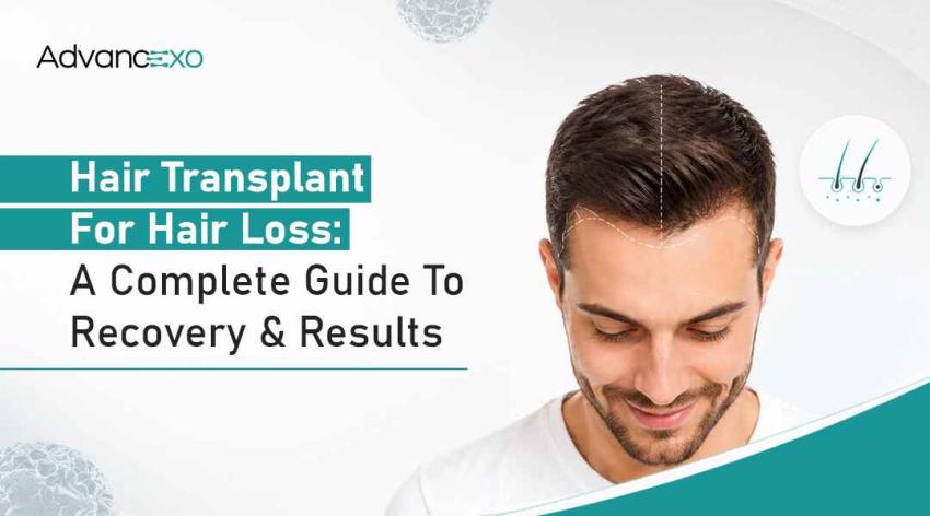 Hair Transplant for Hair Loss: A Complete Guide to Recovery and Results