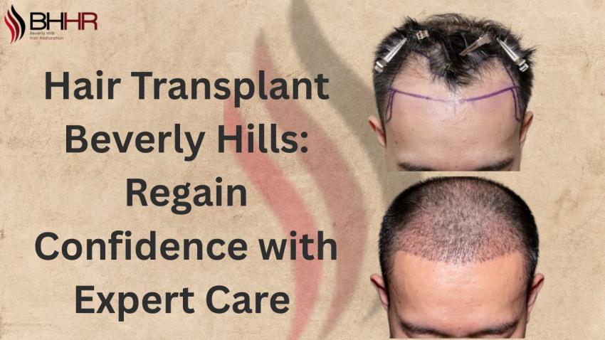 Hair Transplant Beverly Hills: Regain Confidence with Expert Care