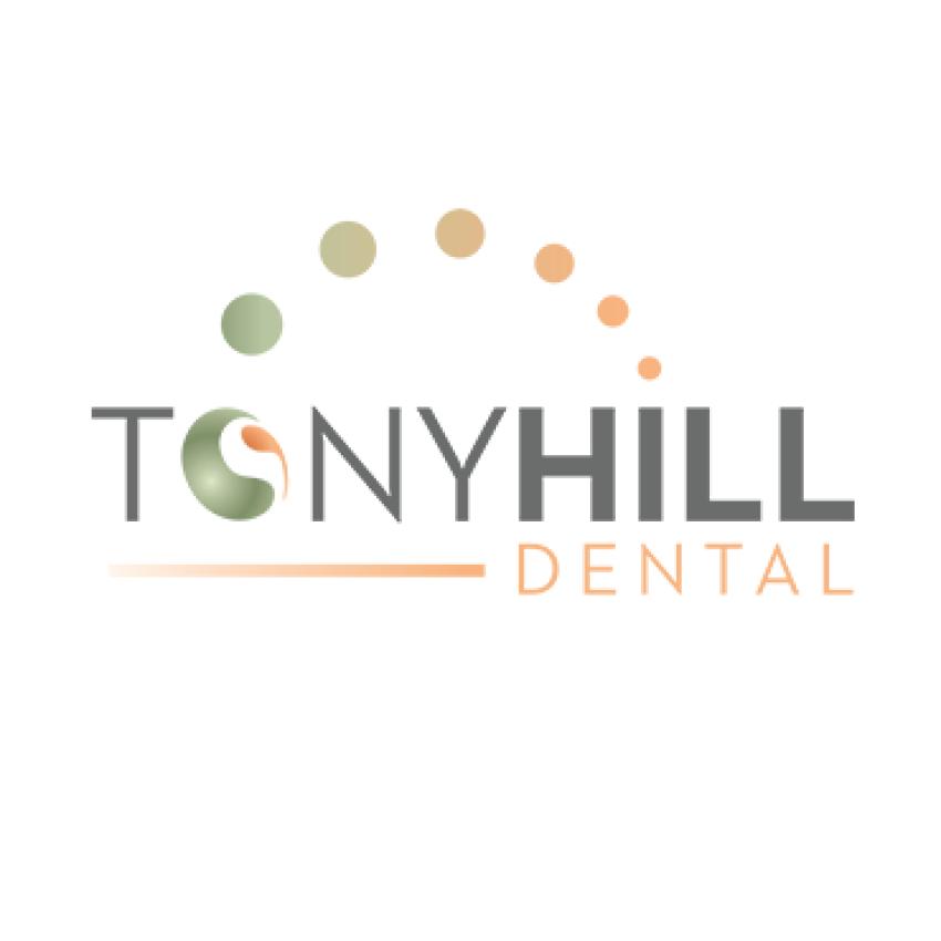 Tony Hill Dental On Why Professional Treatment Outperforms Over-the-Counter Kits