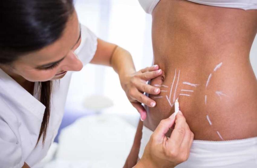Can Liposuction Help Improve Body Confidence?