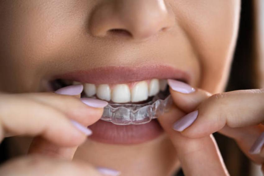 What to Look for When Searching for a Trusted Dentist Near Me