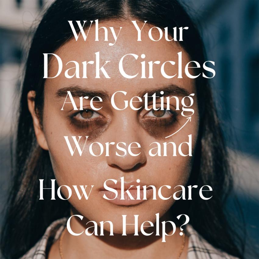 Why Your Dark Circles Are Getting Worse and How Skincare Can Help?