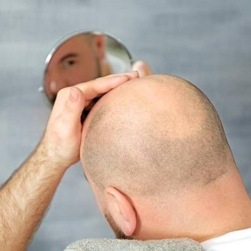 تألق بشعر كثيف ومظهر متجدد: سر العناية المتكاملة بعد العملية في عيادة تجميل دبي