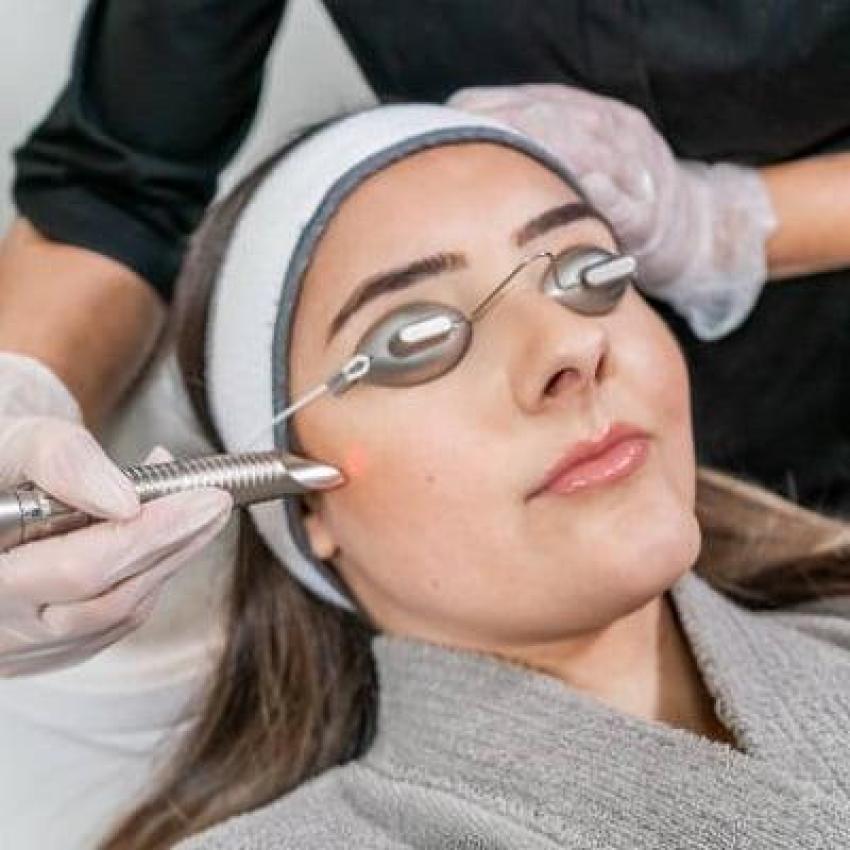 للرجال أيضاً: دليلك الشامل لإزالة الشعر بالليزر في دبي لمظهر أنيق ونظيف
