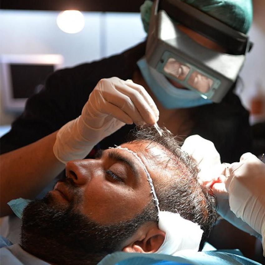 مميزات زراعة الشعر في دبي التي تقدمها عيادة تجميل دبي